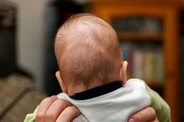 Bebeklerde görülen kafa şekil bozuklukları neden olur?